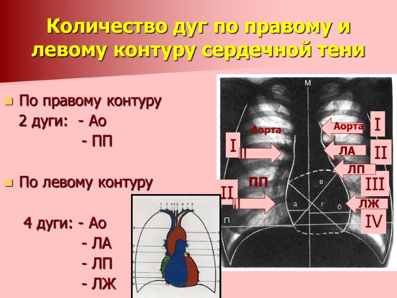 Количество дуг по правому и левому контуру сердечной тени  По правому контуру 